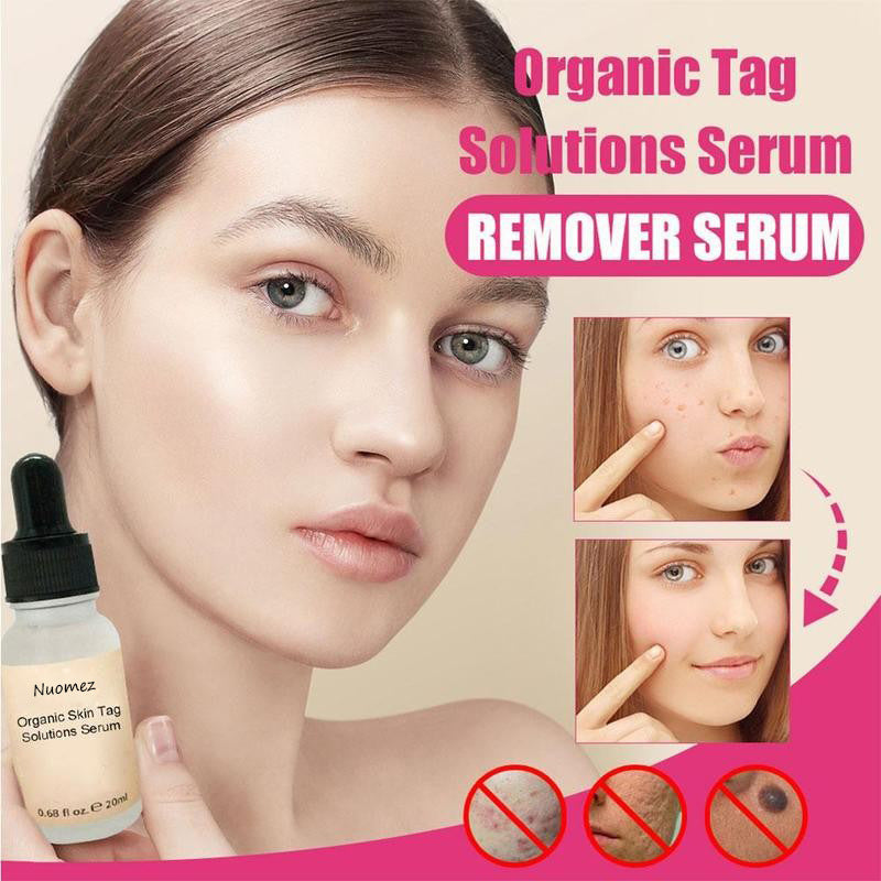 All Natural Skin Tag Remover Serum