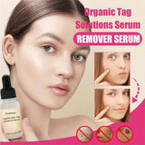 All Natural Skin Tag Remover Serum