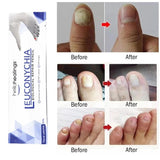 Onychomycosis Nail Care Pen