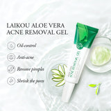 Aloe Acne Treatment Gel Face Cream Serum Anti Acne Scar Cream Shrink Pores Moisturizing Oil Control Soothing Skin Care