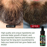 Moisturizing  Mist Beard Care Intensive Fluid Treatment Oil