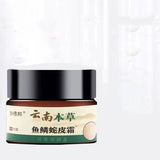 Scale Snake Skin Tartaric Acid Body Lotion Moisturizing Repair Skin Skin care lotion