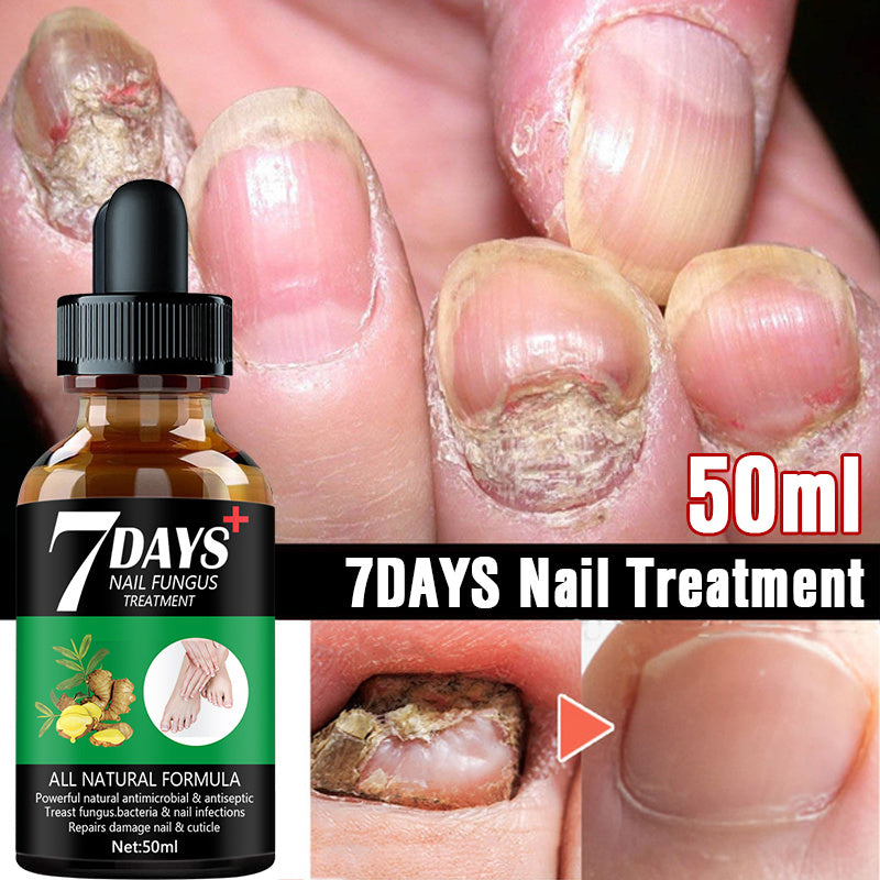 7DAYS Nail Fungus Treatment Serum Care Hand And Foot Care Removal