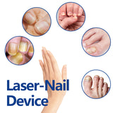 Repair Soft Nail Care Phototherapy Device