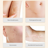 Scar Removal Stretch Marks Serum