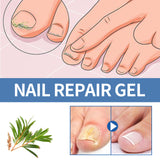 Nail Fungus Care Gel Repair