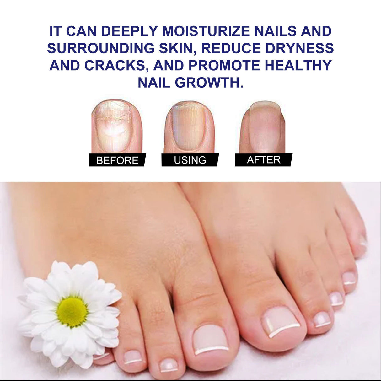 Repair Hand And Foot Soft Nail Thickening Nail Care Solution