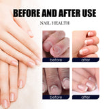 Repair Hand And Foot Soft Nail Thickening Nail Care Solution