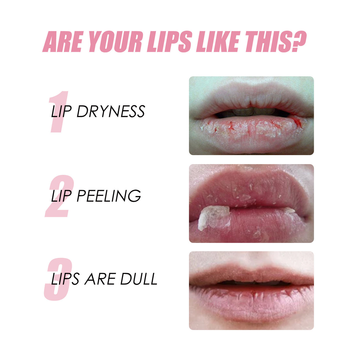 Honey Moisturizing Lip Oil Fade Lip Lines