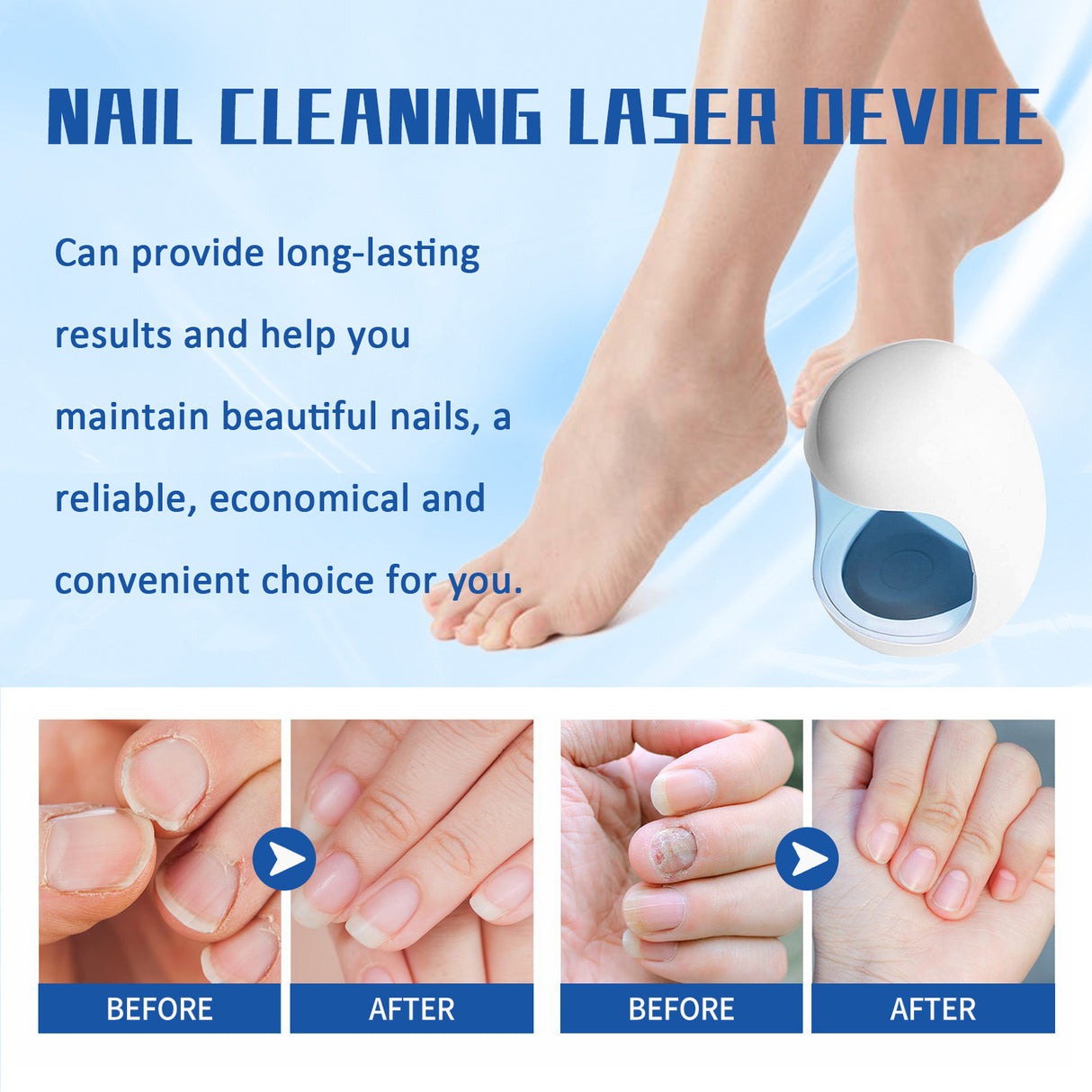 Nail Care Phototherapy Device Gentle Cleaning