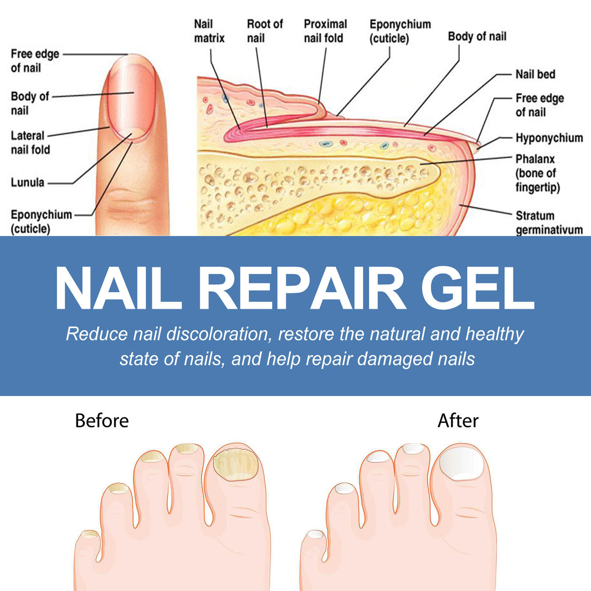 Nail Fungus Care Gel Repair