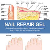 Nail Fungus Care Gel Repair