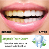 Tooth Whitening Serum Cleanse Mouth Odor