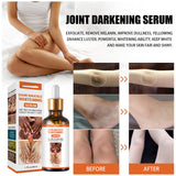 Joint Darkening Serum To Lighten Melanin