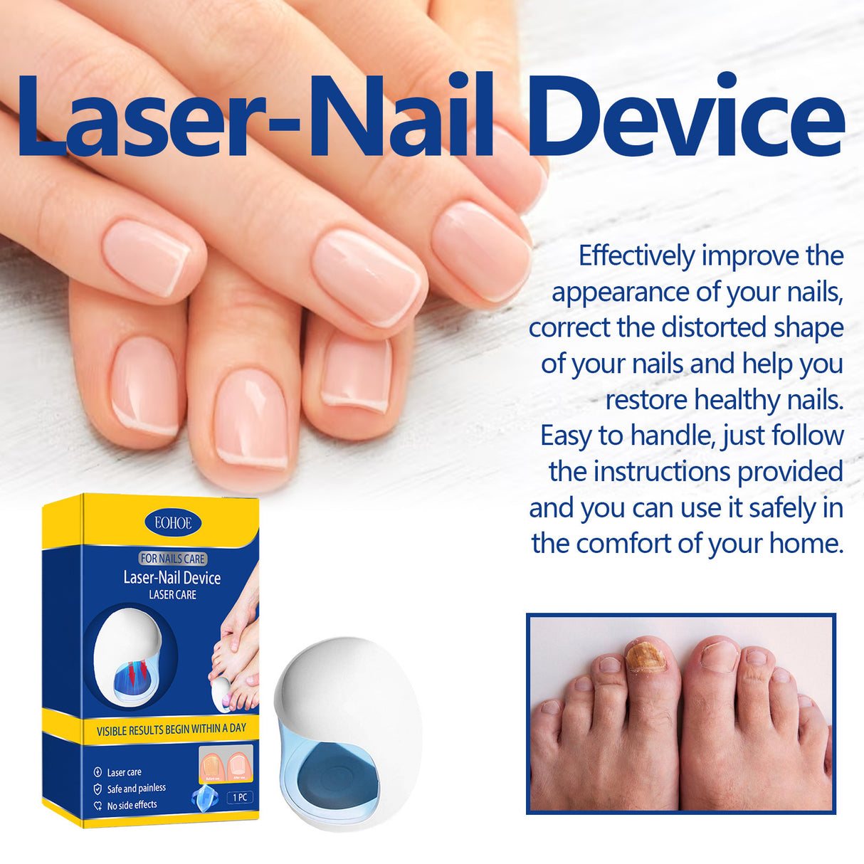 Repair Soft Nail Care Phototherapy Device