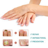 Thickened Nail Repair Patch Care